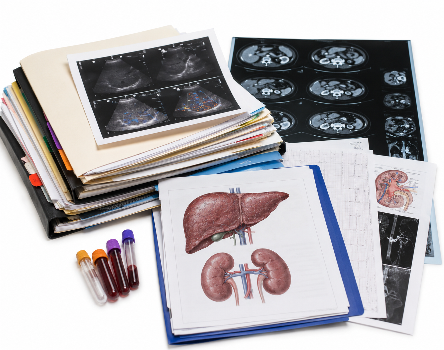 Medical imaging reference for reviewing liver and kidney dysfunction