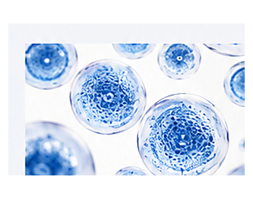 Patient diagnosis and medical records used to compare disease-specific stem-cell evidence